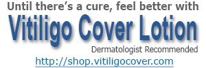 Different Types of Vitiligo • Vitiligo Cover