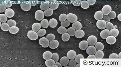 What Is a Staph Infection? - Causes, Symptoms & Treatments - Video ...