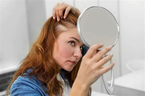 What is frontal fibrosing alopecia? - Cibo Clinic ️