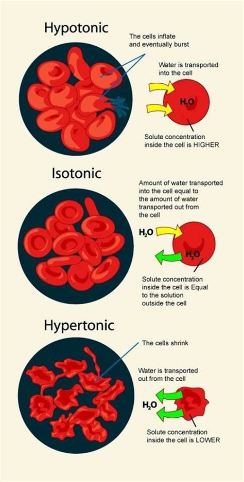 Hypotonic, hypertonic, isotonic | Medical misc. | Pinterest