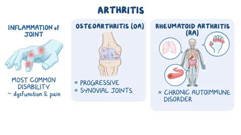 Osteoarthritis: Symptoms, Causes, Risk Factors,, 52% OFF