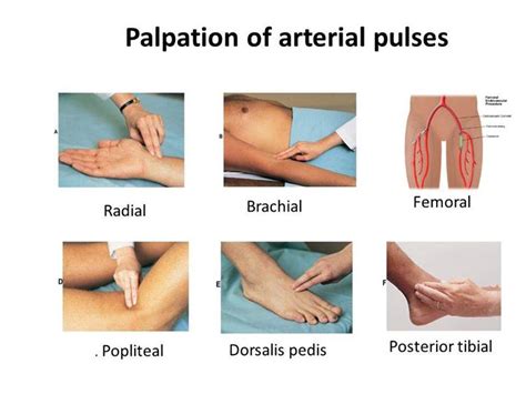 Study Medical Photos: Palpation of Arterial Pulses - Pictures