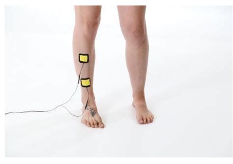 TENS Program Series 19. How to Use a TENS Unit with Shin Pain (Lower ...