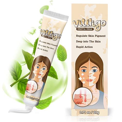 EFINITYER Vitiligo Treatment Cream for Skin Pigmentation in Nepal at ...