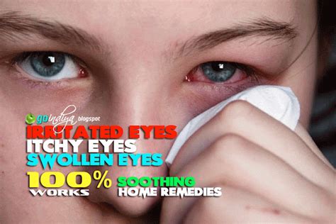 Red, itchy eyes? 25 Home Remedies for Soothing Itchy, Swollen ...