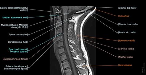 Cervical spine MRI: normal anatomy | e-Anatomy