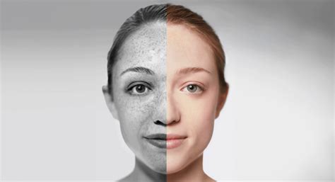 Skin Aging: The causes, effects, and how to slow it – Elysium Health