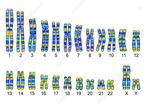 Human Karyotype - Stock Image C013/0007 - Science Photo Library