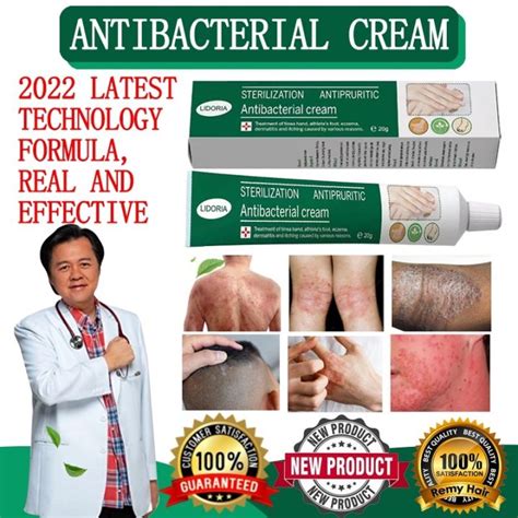 ↂ♚ Eczema Antifungal Cream ointment anti fungal Psoriasis cream ...