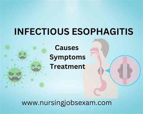 INFECTIOUS ESOPHAGITIS: Causes Symptoms Treatment - Nursing Jobs Exam