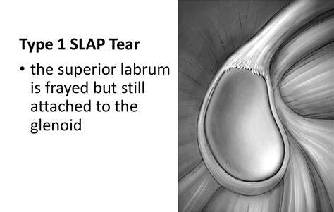 Shoulder Anatomy Slap