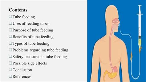 SOLUTION: Presentation topic tube feeding and its types - Studypool