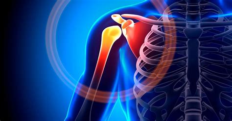 Shoulder Bursitis Causes