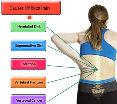 Causes of Back Pain: What Causes Back Pain? - HealthNormal