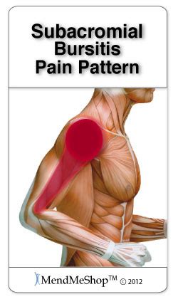 Symptoms of Shoulder Bursitis