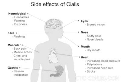 Tadalafil (Generic Cialis) Side Effects