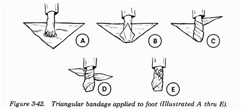 To apply a triangular bandage to the foot-- (FM 21-11 First Aid for ...