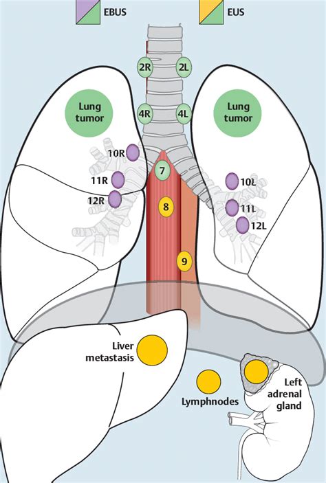 Chest Lymph Node Anatomy