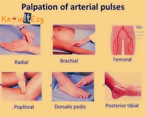 Posterior Tibialis Pulse