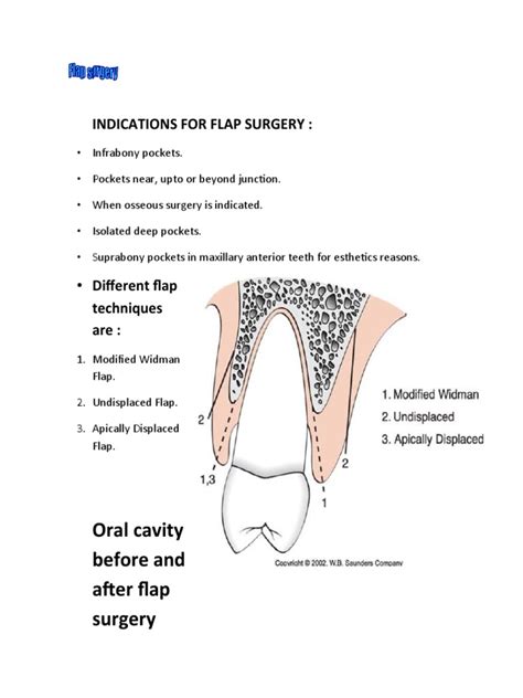 Oral Cavity Before and After Flap Surgery | PDF