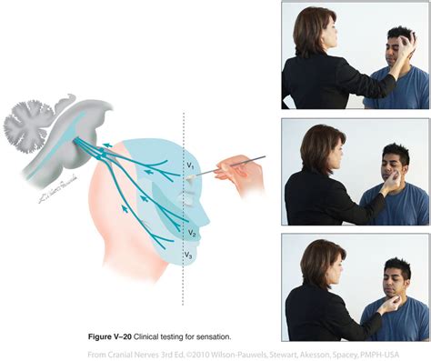 Cranial Nerves 3rd Edition: Trigeminal V