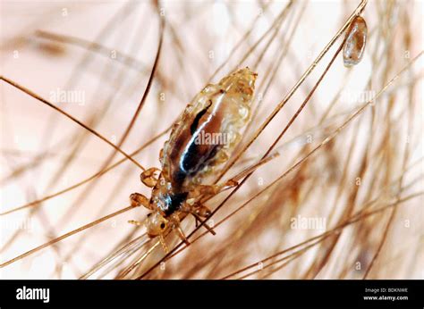 Louse hi-res stock photography and images - Alamy