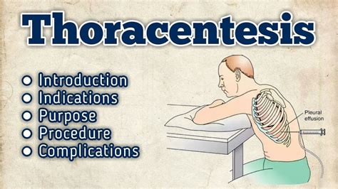 Thoracentesis || Procedure in Hindi || - YouTube