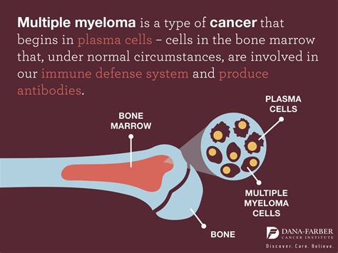 what is multiple myeloma - what is multiple myeloma