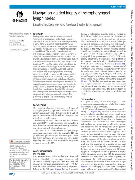 (PDF) Navigation-guided biopsy of retropharyngeal lymph nodes