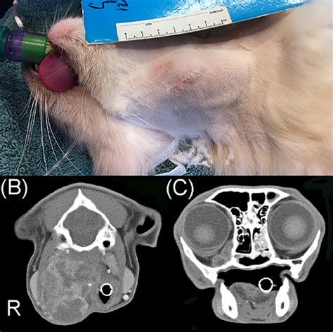 The right medial retropharyngeal lymph node was enlarged (A) and on ...