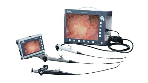 Male cystoscopy recovery time. Male Cystoscopy Recovery: Timeline, Tips ...