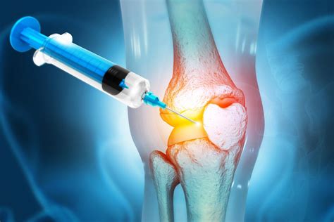 Regenerating Cartilage in the Knee: Treatment Options