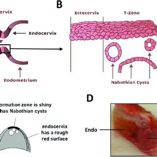 Endocervix Histology