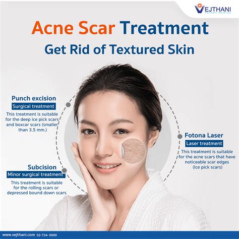 Get Rid of Textured Skin with Acne Scar Treatment @Vejthani Hospital