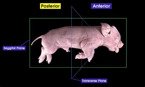 Anterior and posterior | Whitman College