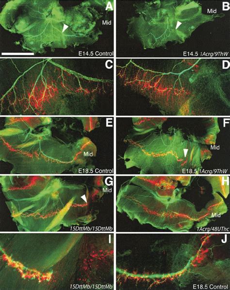 Innervation of the diaphragm by the phrenic nerve. (A) In control mice ...