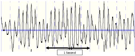 Alpha Waves - Scottsdale Neurofeedback Institute, AZ