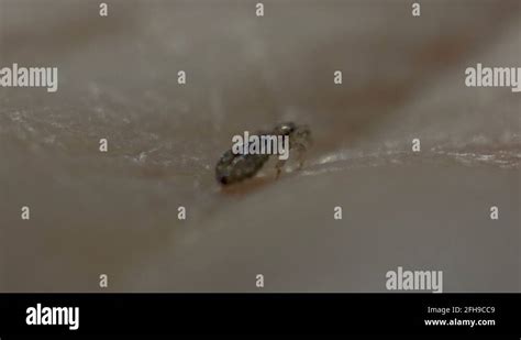 Body louse microscope Stock Videos & Footage - HD and 4K Video Clips ...