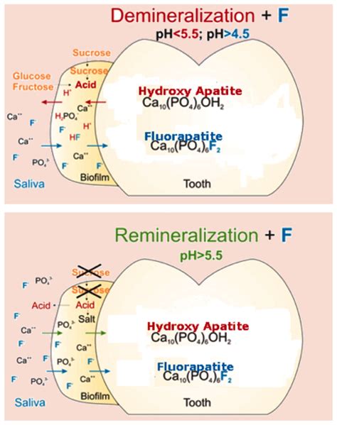 Arginine can help prevent tooth decay - AdVance Dental PC | Dentist ...