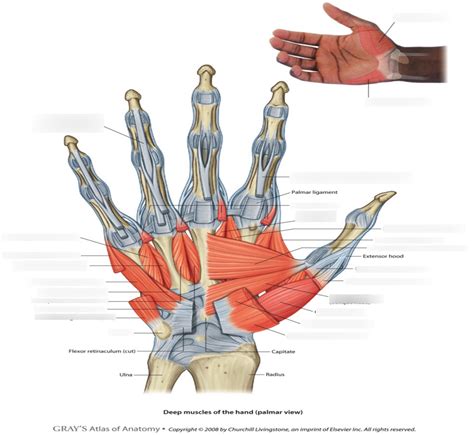 Deep muscles of the hand (palmar view): Anatomy 1 Diagram | Quizlet