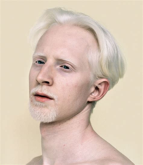 15+ Albino People Who’ll Mesmerize You With Their Otherworldly Beauty ...