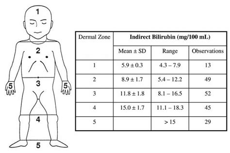 Newborn Jaundice 101 (Complete Guide For Parents) | Ethissa