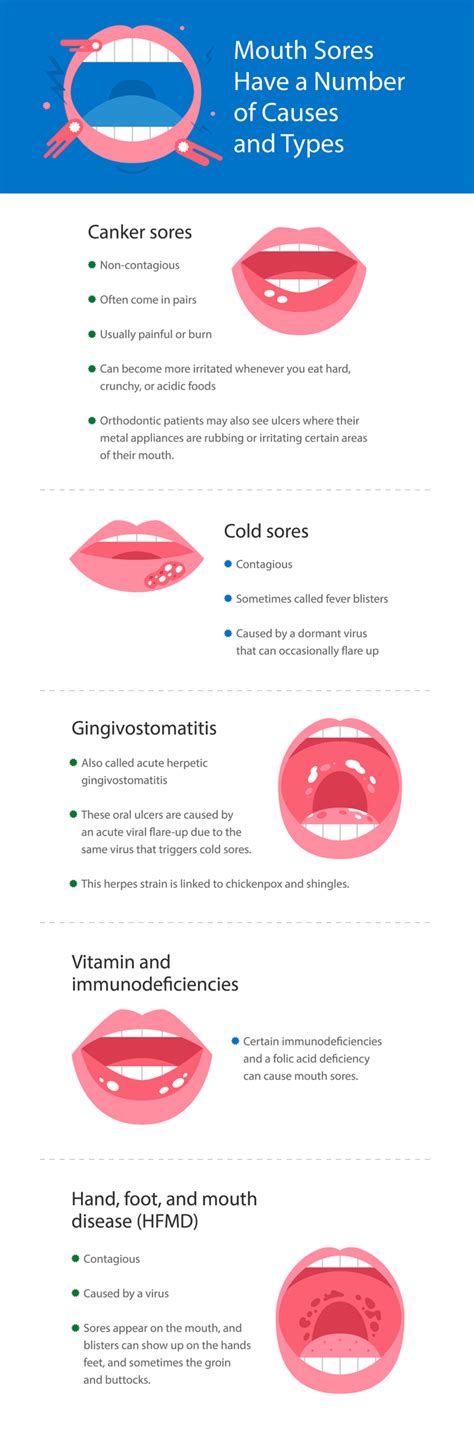 Mouth Sores: What They Are and How to Get Rid of Them - SmartMouth