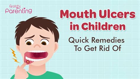 Sores On Lips Toddler | Lipstutorial.org