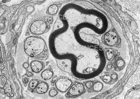 Myelinated and Unmyelinated Nerve Fibe | Stock Image - Science Source ...