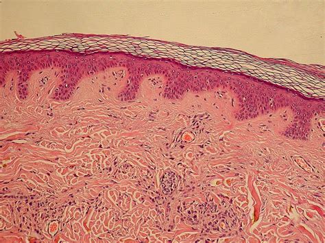 Skin care - Skin physiology - Function of epidermis | the dynamic ...