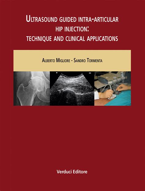 Ultrasound Guided Intra-Articular Hip Injection: Technique and Clinical ...