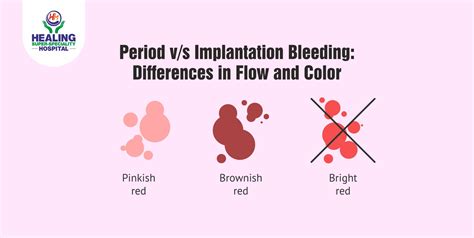 Period v/s Implantation Bleeding: Differences in Flow and Color