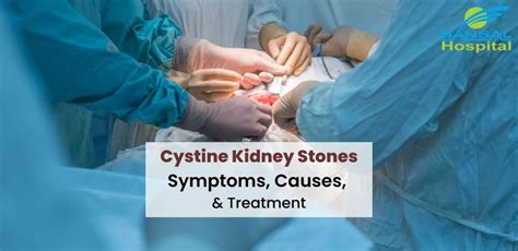 Cystine Kidney Stones: Symptoms, Causes, And Treatment