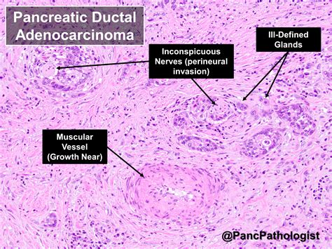 Pancreatic Duct Histology